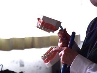 歯科保健指導